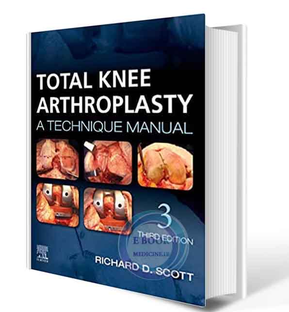 دانلود کتاب Total Knee Arthroplasty: A Technique Manual 3rd 2020 ( PDF)